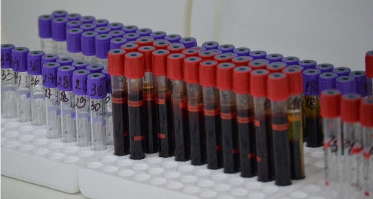 За год 90 жителей Новочебоксарска смогли полностью вылечиться от гепатита 