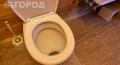 Гости теперь восхищаются моим унитазом: йод за 30 рублей сделает его белее снега — вот как использовать